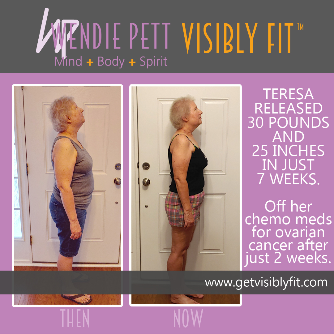 Before & after photos of Teresa showing her 30 pound weight loss and how she has maintained it a year later thanks to Wendie Pett, ND